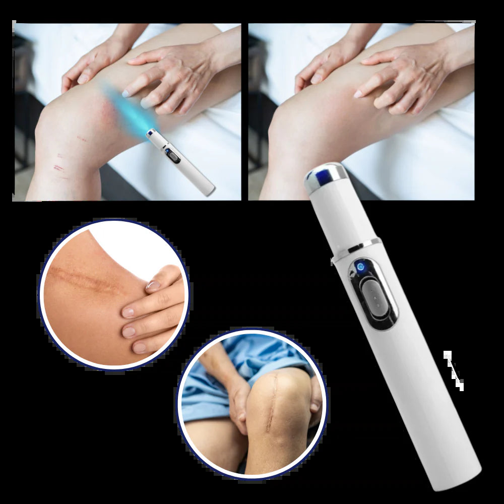 Dark Spot Remover Blue Laser Pen