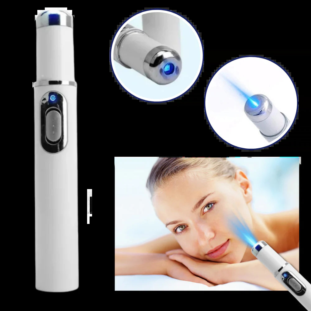 Dark Spot Remover Blue Laser Pen